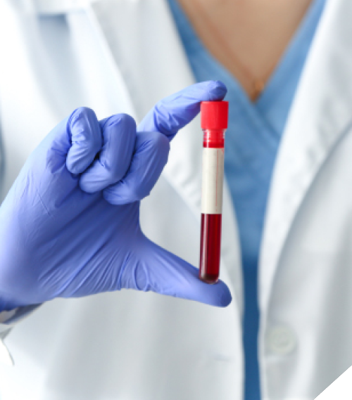 Doctor holding test tube with blood sample, closeup